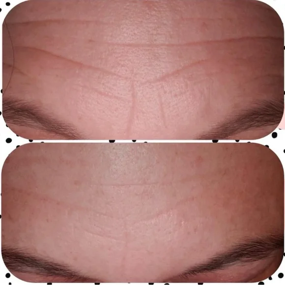 Nu Skin Tru Face Line Corrector Serum - Picture 5 of 6